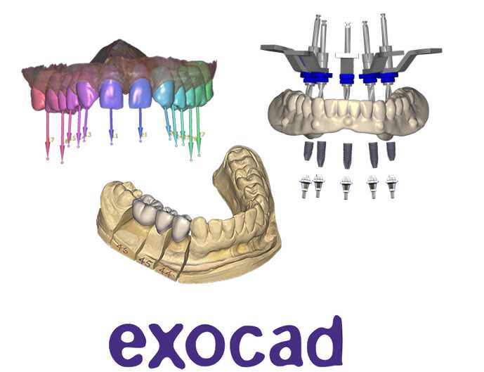 Exocad