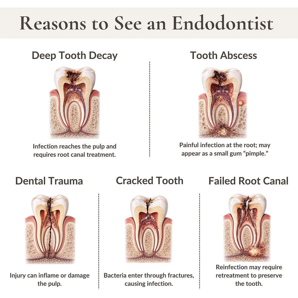Infographic showing reasons to see an endodontist including deep tooth decay, tooth abscess, dental trauma, cracked tooth, and failed root canal at NYC Dentistry Center in Midtown Manhattan