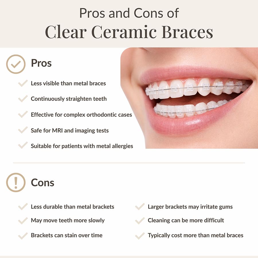 Infographic explaining the pros and cons of clear ceramic braces with transparent orthodontic brackets used to straighten teeth