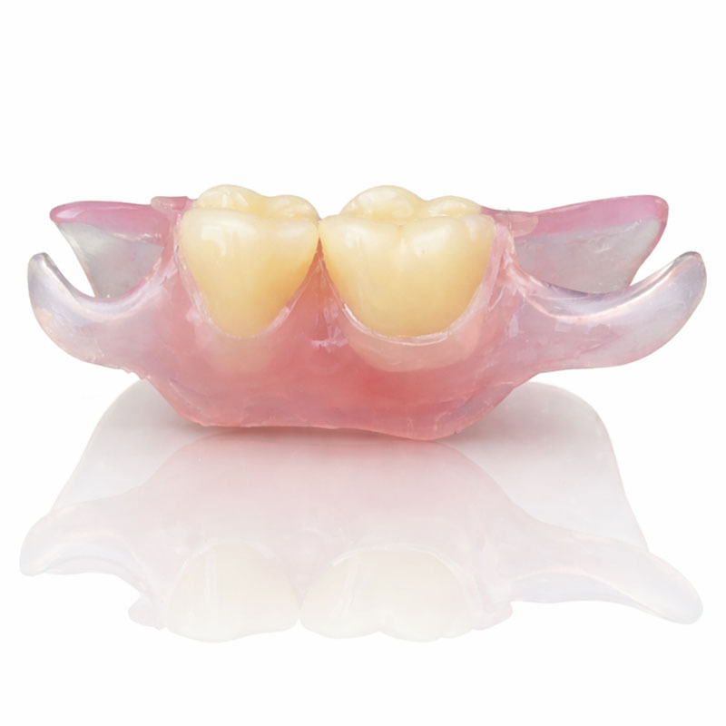 Nesbit partial denture NYC – removable flexible solution for replacing missing molars with natural appearance and comfortable fit